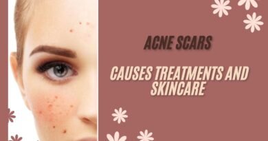 Acne-Scars-Causes-Treatments-Skincare